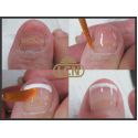Гель для протезирования ногтей с антимикозным эффектом